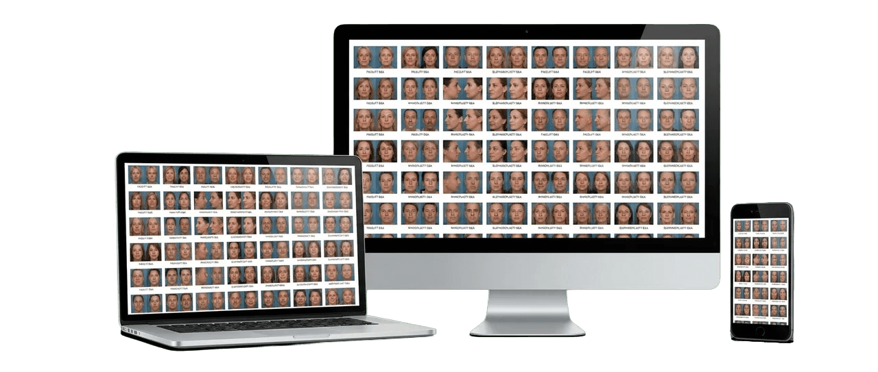 A before-and-after gallery deployed across laptop, desktop, and phone, what an activated asset library looks like in the wild