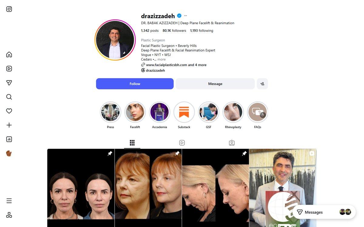 Babak Azizzadeh — Instagram profile
