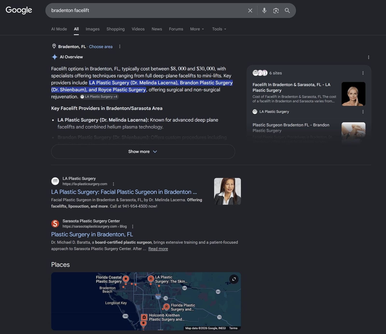 Dr. Lacerna owning the facelift search results in her market