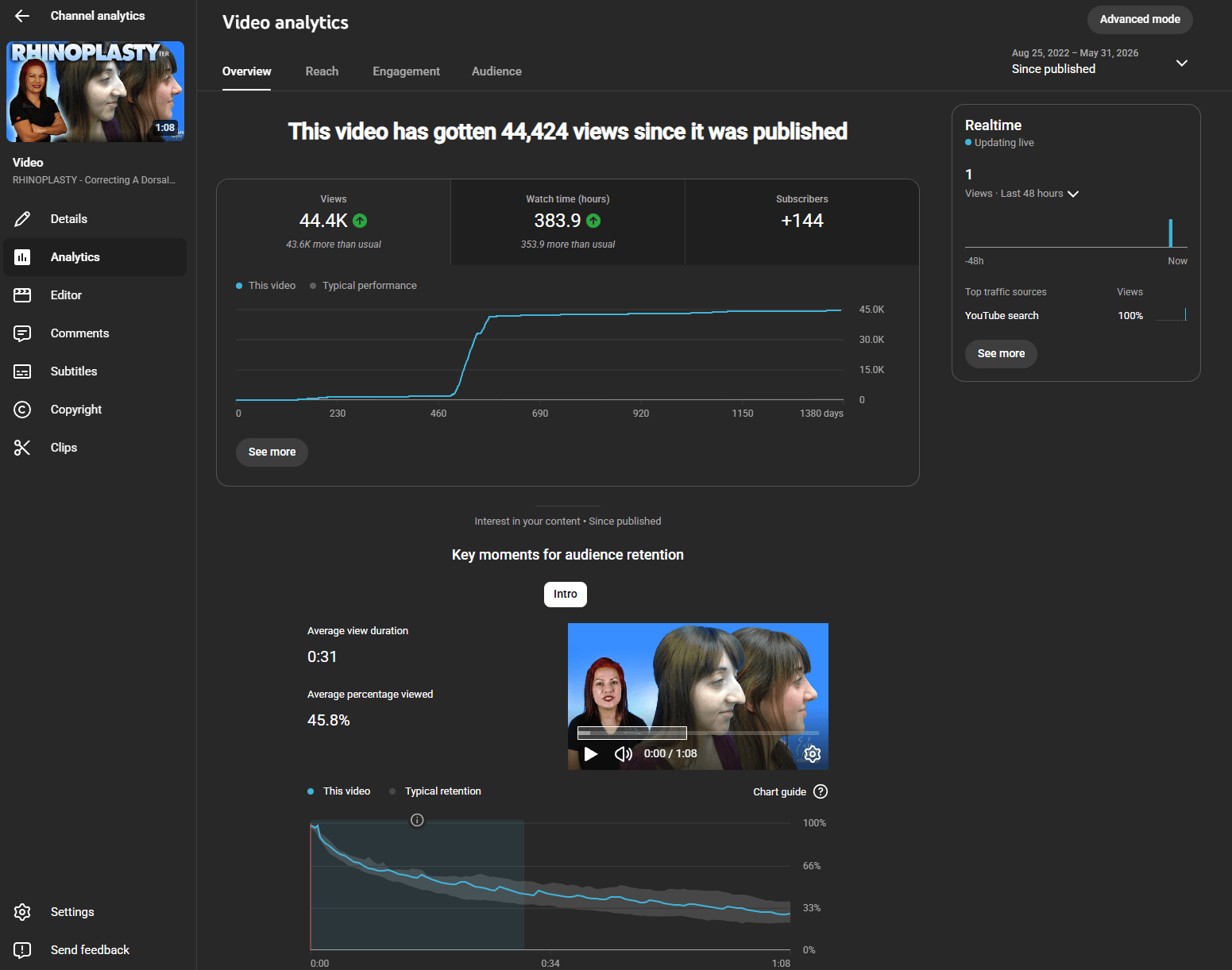 YouTube Studio analytics — 44.4K views, 383.9 watch-time hours, 45.8% average viewed, +144 subscribers from one rhinoplasty case study