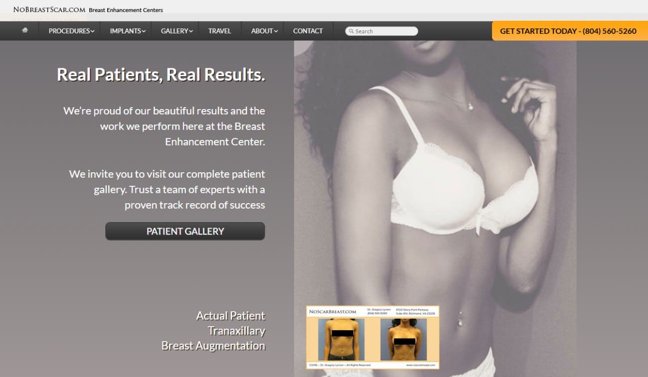 NoScarBreast.com — scarless transaxillary breast augmentation